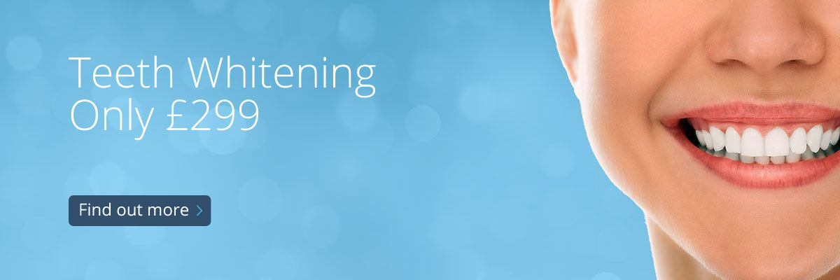 Teeth Whitening Only £299 - Find out more
